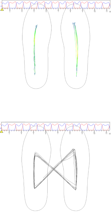 3D-Fußscan: Heatmap bei der digitalen Fußvermessung